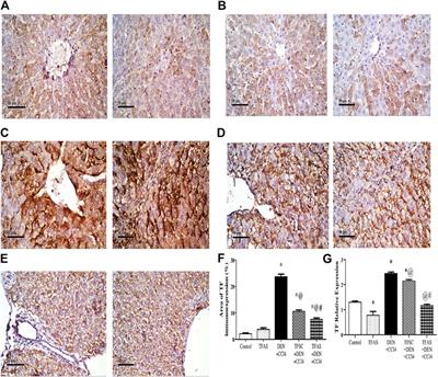 Antisense Tissue Factor Oligodeoxynucleotides Protected Diethyl Nitrosamine/Carbon Tetrachloride-Induced Liver Fibrosis Through Toll Like Receptor4-Tissue Factor-Protease Activated Receptor1 Pathway